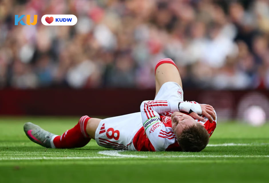 Arteta Hadapi Masalah Cedera Arsenal Dua Bek Kunci Tinggalkan Timnas (1)